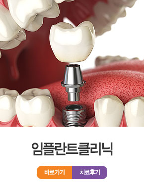 ���ö�ƮŬ����